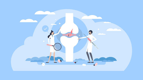 Illustration of two scientists examining inflammation around a joint. 