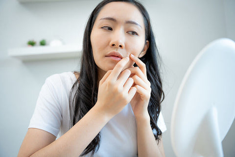 Vitamin C: The Secret Weapon Against Acne?